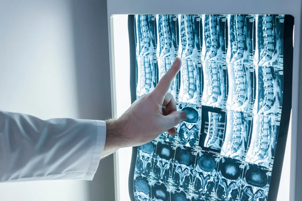 chiropractor who can do a spine xray in office in Scottsdale.