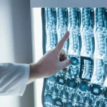 chiropractor who can do a spine xray in office in Scottsdale.