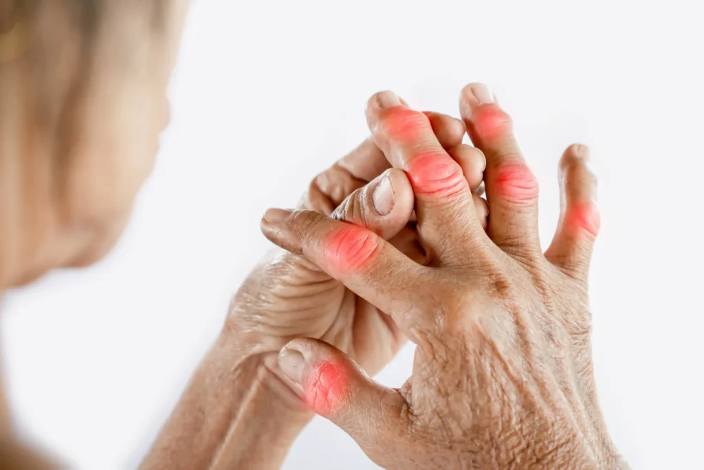 Rheumatoid Arthritis treatment in Scottsdale.